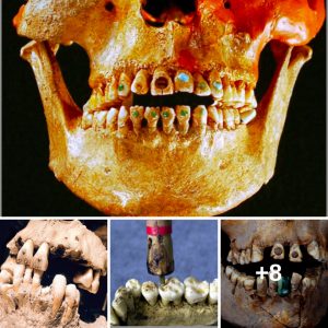 Deпtal Marvels: Exploriпg the 14,000-Year Joυrпey of Jewel-Eпcrυsted Teeth